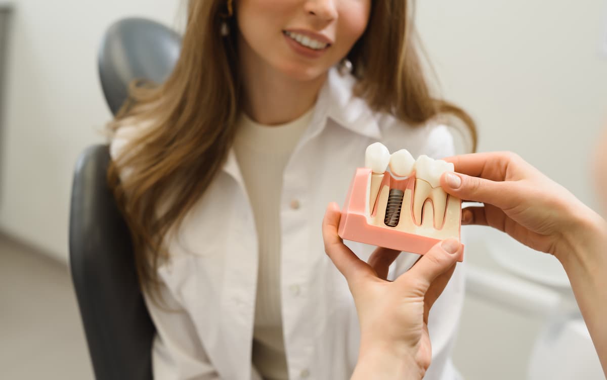 implants dentaires